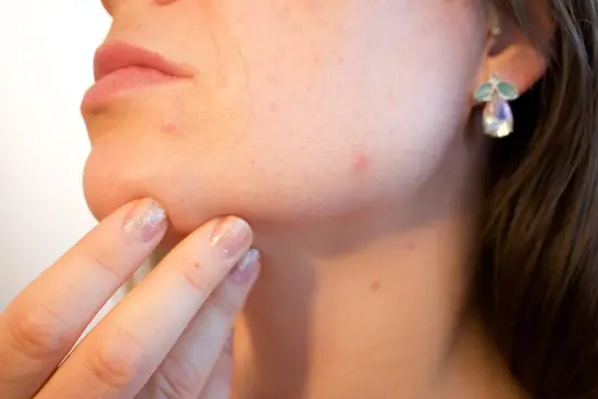 Online Hautanalyse, die schnelle Hilfe für die Haut